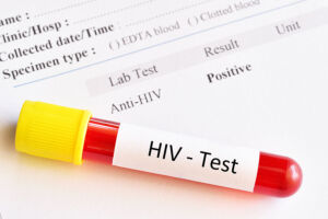 bagaimana cara penularan hiv