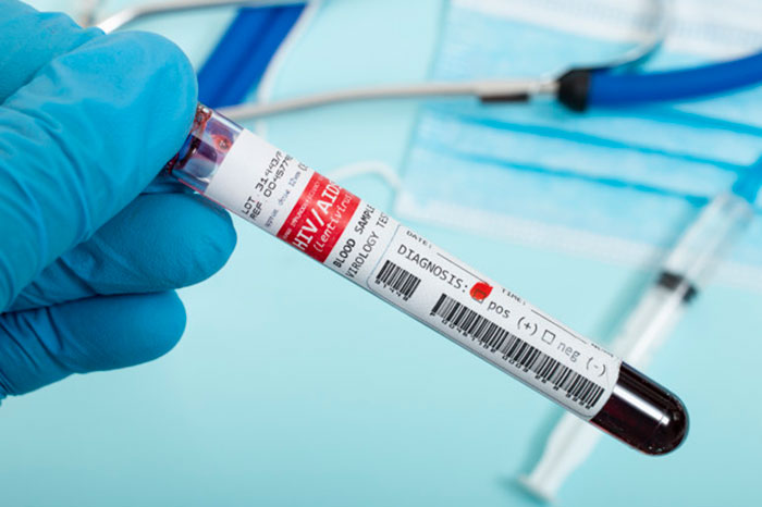 Begini Cara Penularan HIV/AIDS yang Harus Anda Waspadai