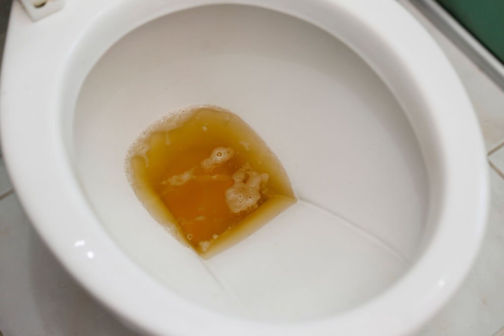 urine gelap